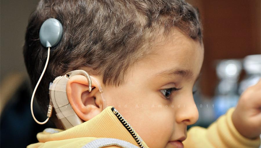 القوقعة الصوتية