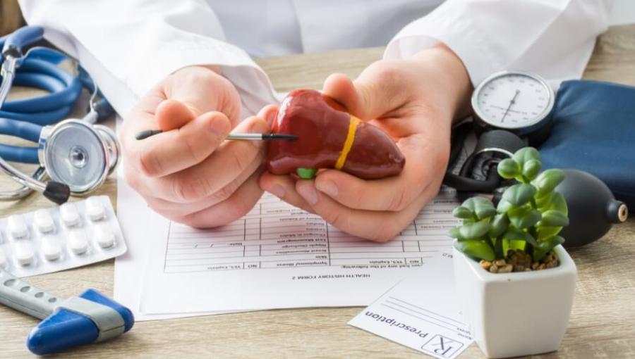 طبيب يمسك بمجسم للكبد | تعبيرية