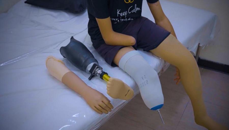 أحد الأطفال المستفيدين من حملة استعادة الأمل لمبتوري الأطراف في غزة | حسنى