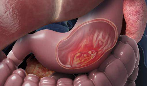 صورة تعبيرية