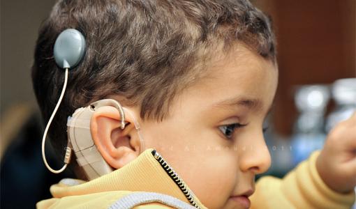 القوقعة الصوتية