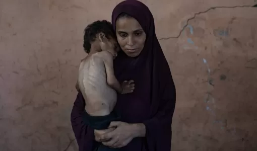 الطفل الفلسطيني يزن أبو فول البالغ من العمر عامين تحمله والدته نعيمة وهو يعاني من سوء تغذية حاد بسبب نقص الغذاء الناجم عن الحصار الذي يفرضه الاحتلال على قطاع غزة وإغلاق المعابر | المصدر: الوكالة الأوروبية للصور الصحفية