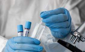 فحص الكشف عن كورونا PCR | صورة من الانترنت